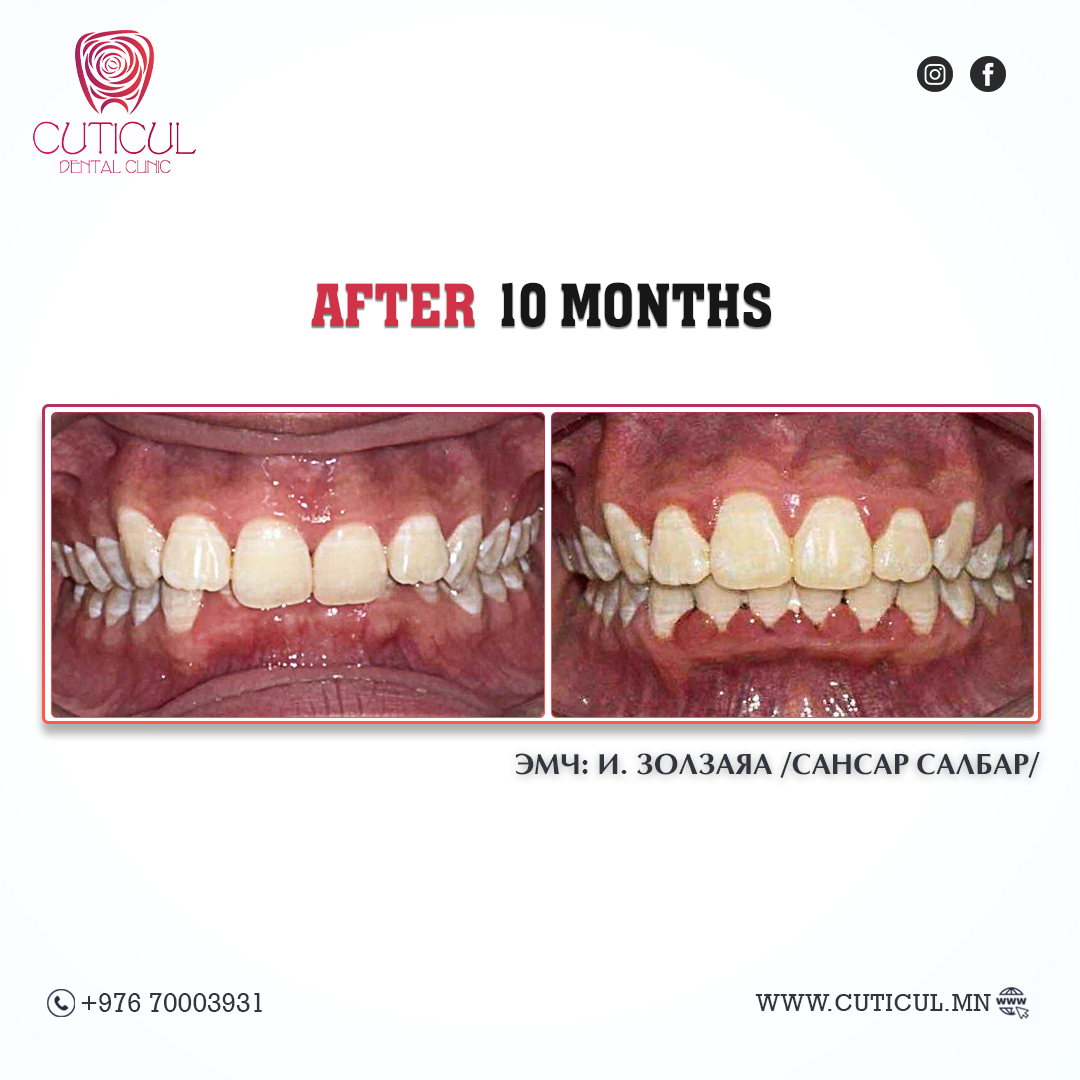 Result Image 4